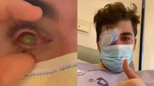 Mike Krumholz Kehilangan Penglihatan Setelah Tidur Dengan Lensa Kontak yang Masih Terpasang