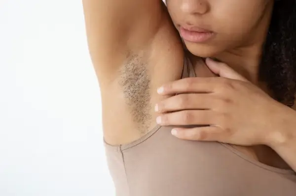 4 Penyebab Ketiak Hitam dan Cara Mengatasinya