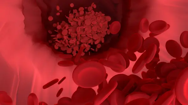10 Makanan Penambah Darah yang Ampuh untuk Meningkatkan Hemoglobin dan Mengatasi Anemia
