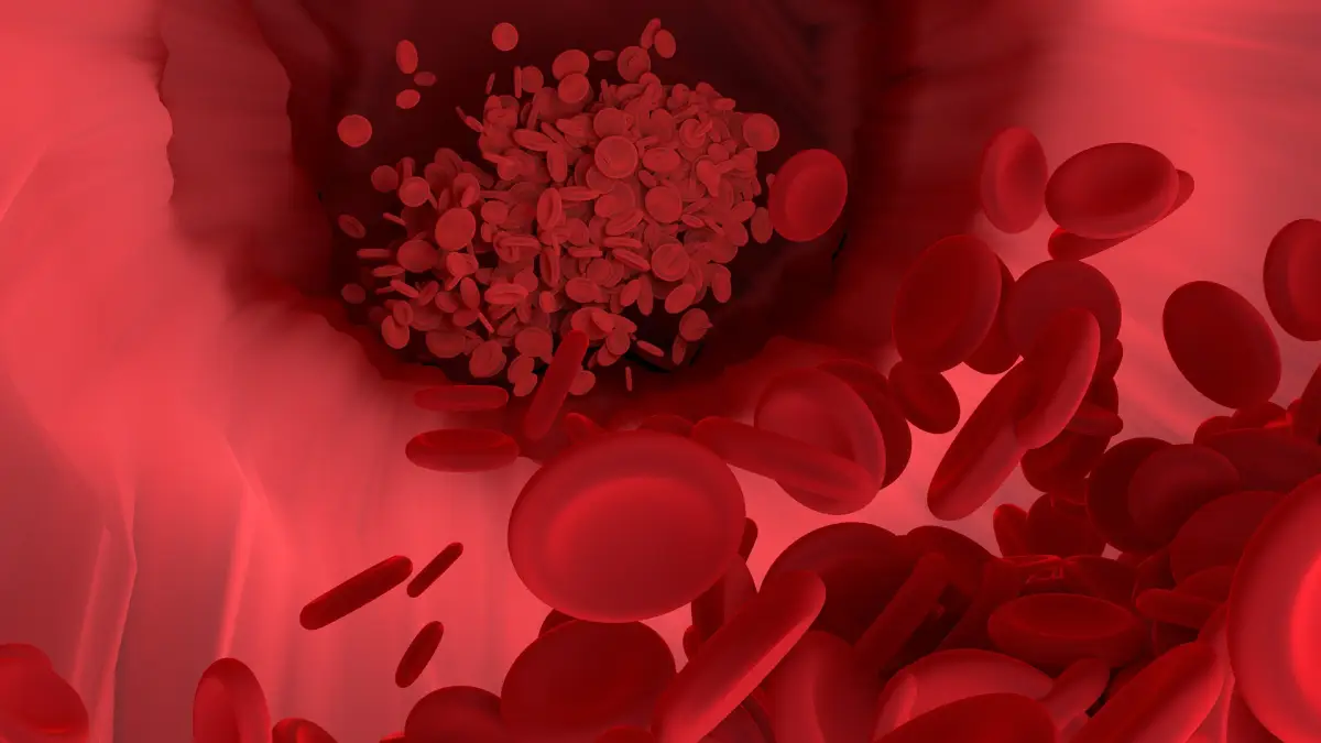 ilustrasi 10 Makanan Penambah Darah yang Ampuh untuk Meningkatkan Hemoglobin dan Mengatasi Anemia (Sumber : PIXABAY / Vector8DIY)